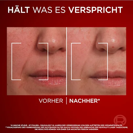 Anti-Aging Face Cream Revitalift Laser X3 SPF 25, 50 ml - Image 3