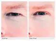 Eyelid lifting strips, anti-drooping eyelid, size M, 64 pieces - Image 2