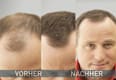 Hair thickening fibers, medium brown, 14 g - Image 6