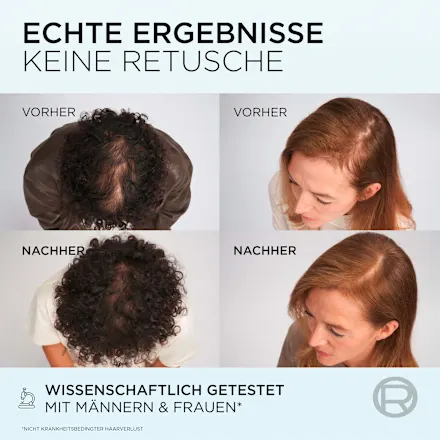 Hair Serum Fiber Booster, Anti-Hair Loss, 102 ml - Image 3